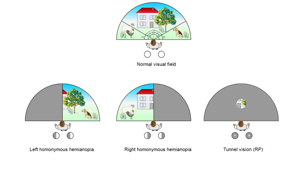 Treino Visuoperceptivo 4 treinovisuo1